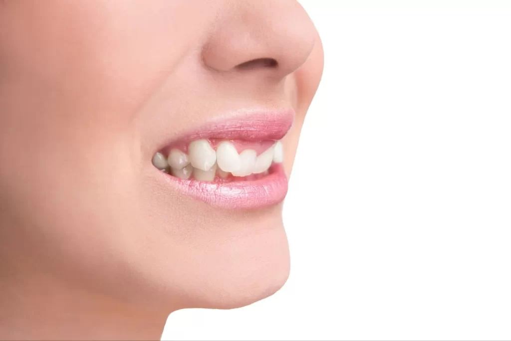 Răng nanh và răng khểnh đều là chiếc răng số 3 trên cung hàm, tính từ răng cửa hướng vào trong