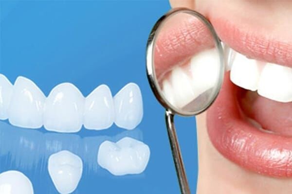 răng toàn sứ Zirconia